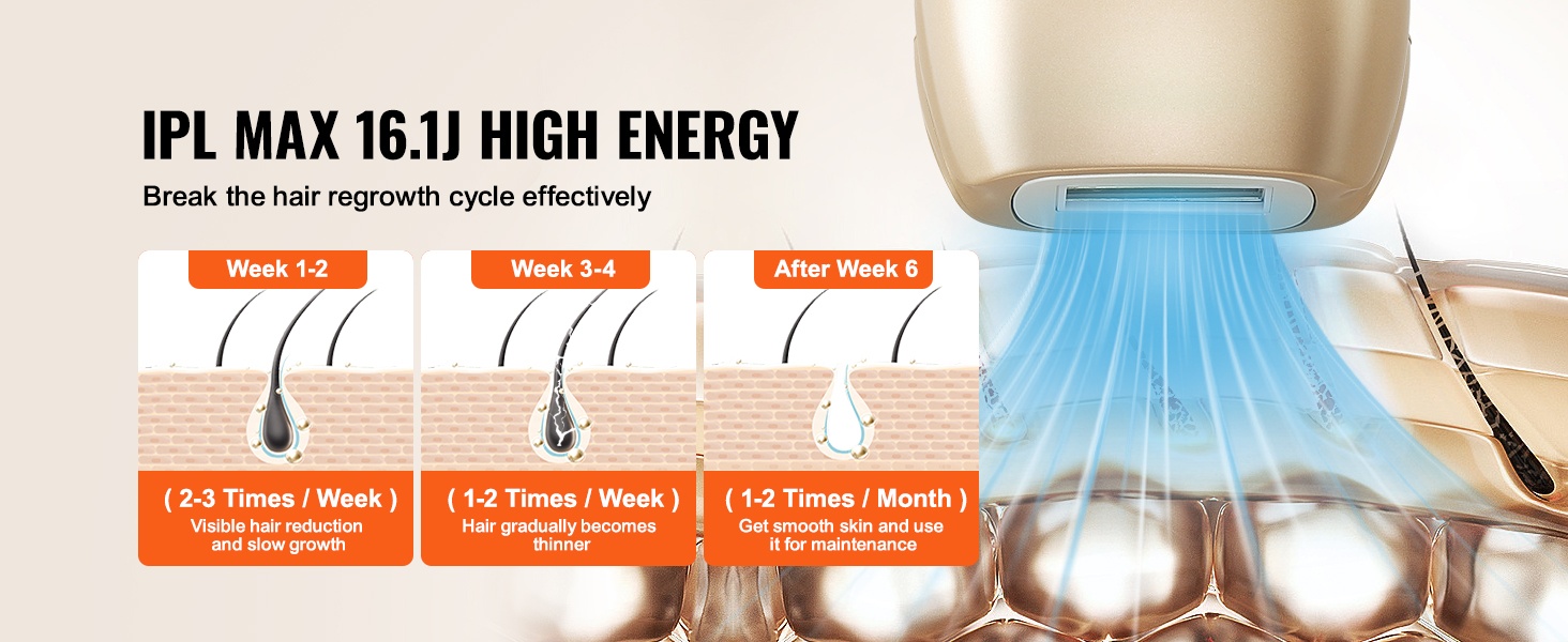 IPL-tekniikka karvatupen käsittelyyn